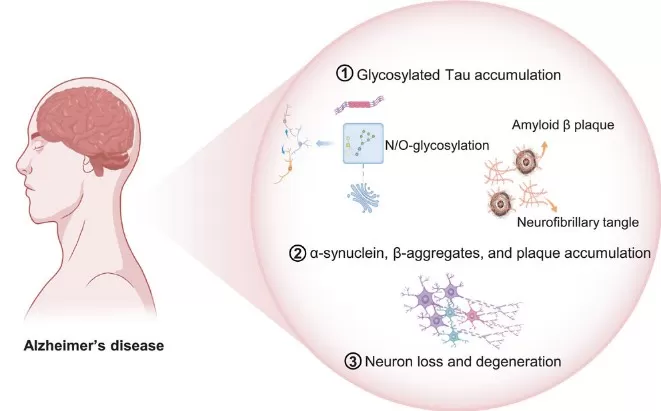 Figure 3. Pathogenesis of Alzheimer’s Disease Figure 3. Pathogenesis of Alzheimer’s Disease